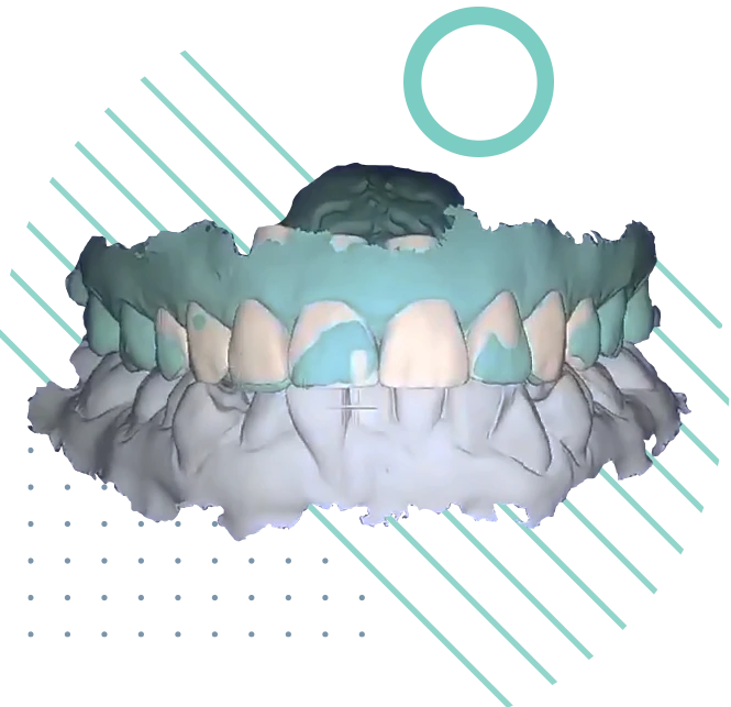 Αισθητική Οδοντιατρική